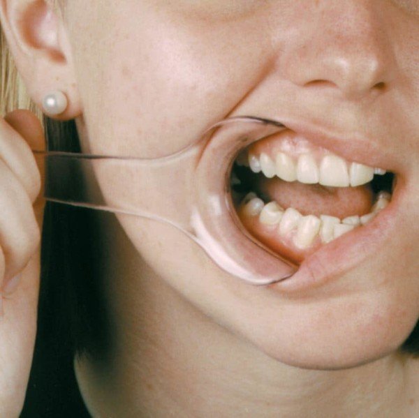 Mirahold Lip & Cheek Retractor Adult Clear -2/Pk